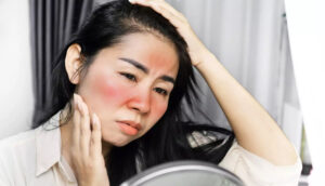 Remedies for sunburn: इन 7 देसी उपायों से मिलेगा सनबर्न से छुटकारा, एक रात में दिखने लगेगा असर, झुलसी हुई त्वचा भी चमकने लगेगी !